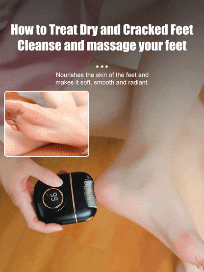 🌷Mother's Day Hot Sale 66% OFF🌸 New digital electric foot polishing machine